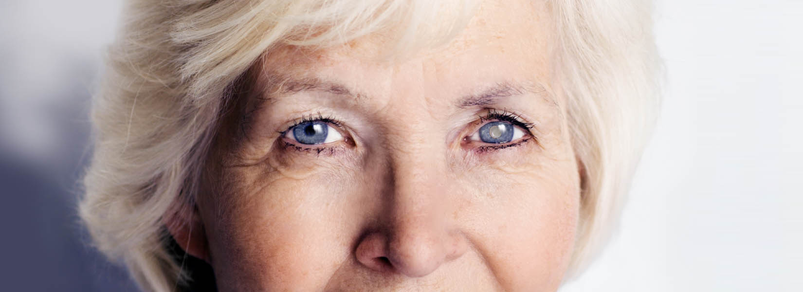 Cataract Surgery in Far West Side